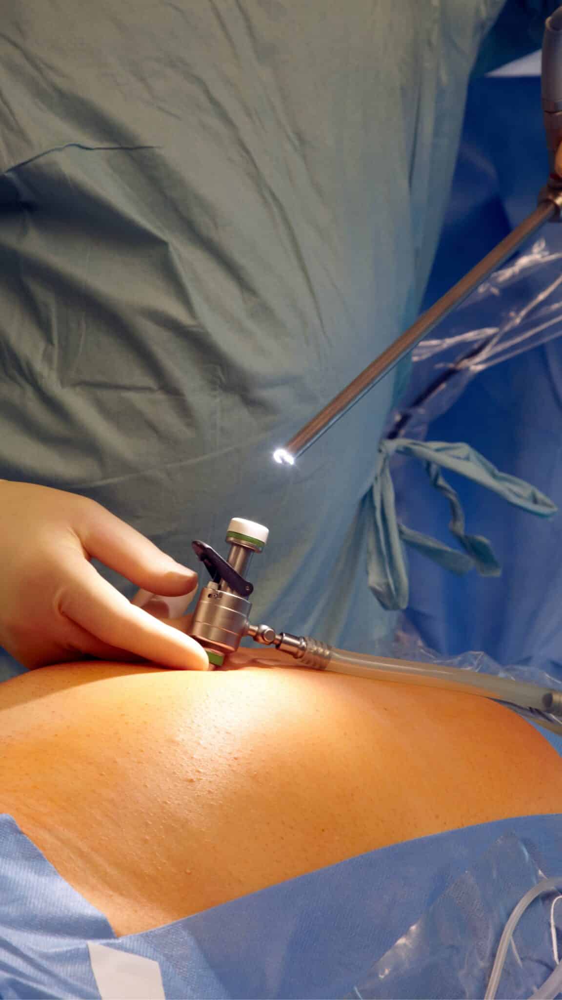 діагностична процедура біопсія: що необхідно знати перед дослідженням?