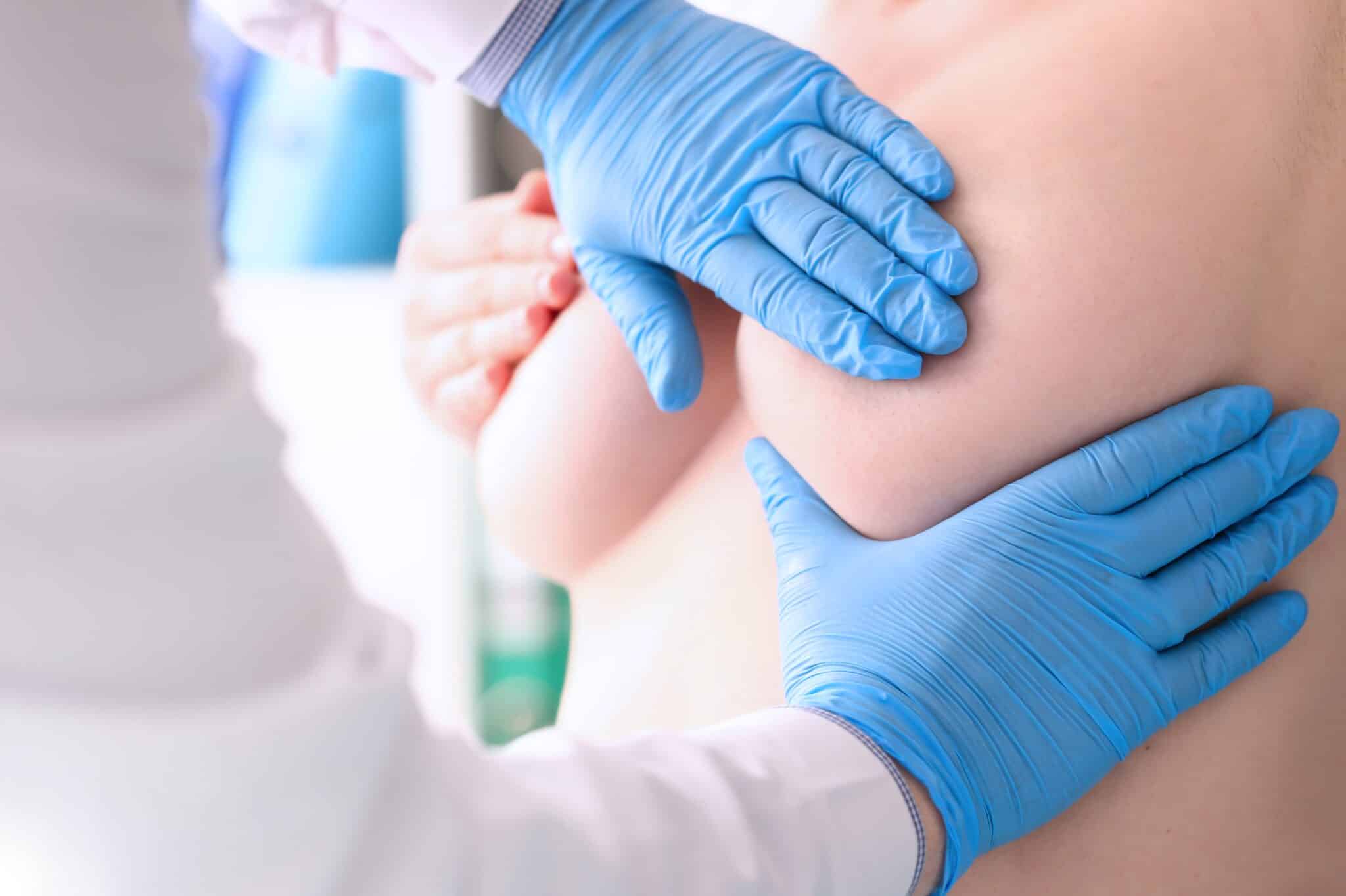 Повторний огляд лікаря мамолога після обстеження в клініці Інновація