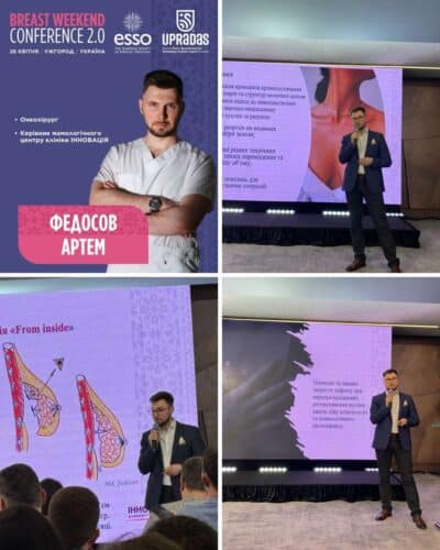 Руководитель Европейского маммологического центра клиники «Инновация» Федосов Артем Эдуардович выступил с докладом по теме «Элегантное моделирование формы молочной железы»